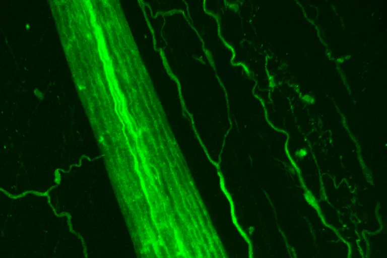 Microscopy image Voets lab